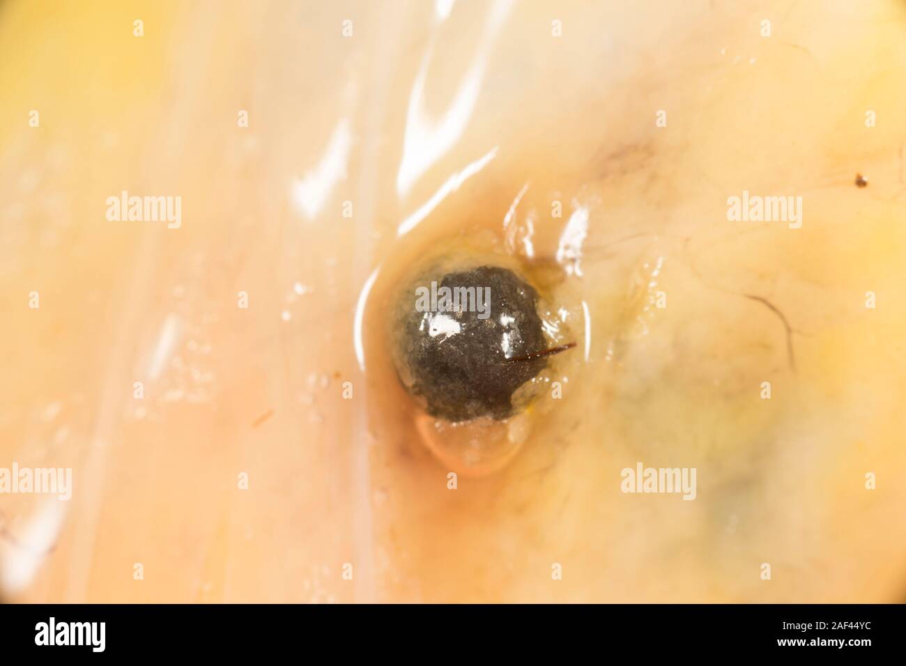 A lead shotgun pellet in the fat of a pheasant being prepared for cooking that was shot on a driven pheasant shoot. England UK GB Stock Photo