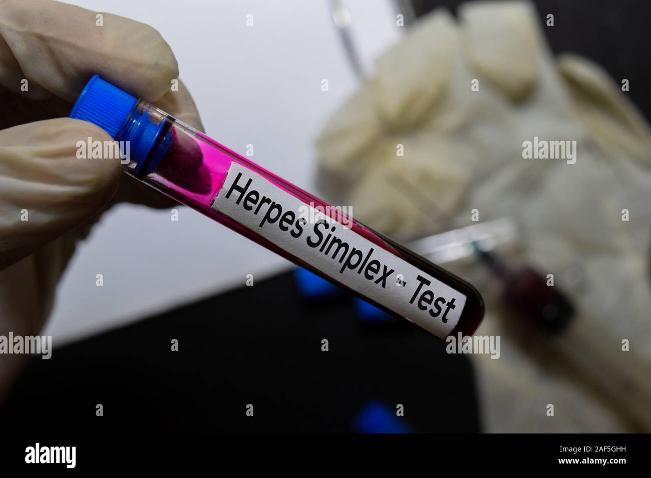 Herpes Simplex - Test with blood sample. Top view isolated on office desk. Healthcare/Medical concept Stock Photo