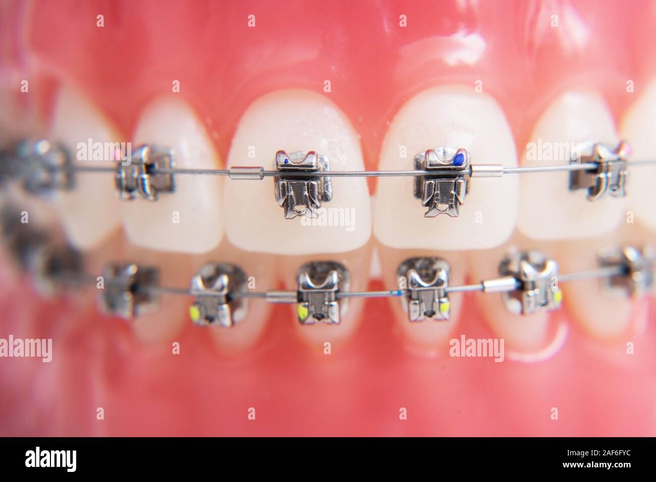macro photography shows how the braces are arranged Stock Photo - Alamy