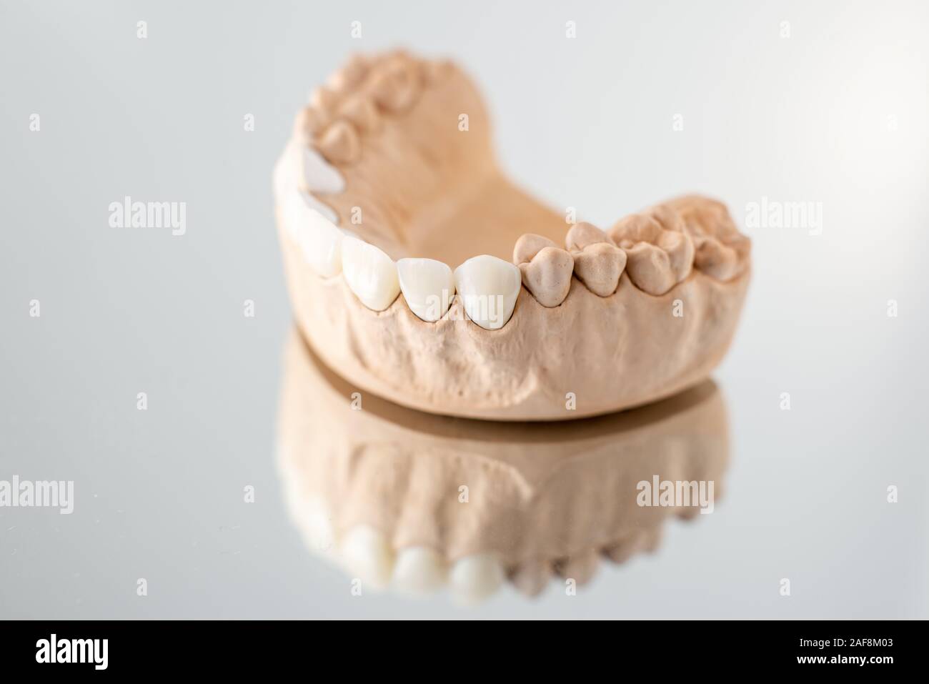 Close-up on plaster model of artificial jaw with veneers on the mirror ...