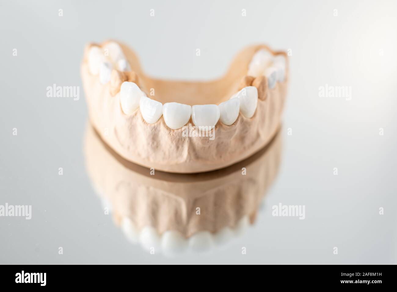 Close-up on plaster model of artificial jaw with veneers on the mirror ...