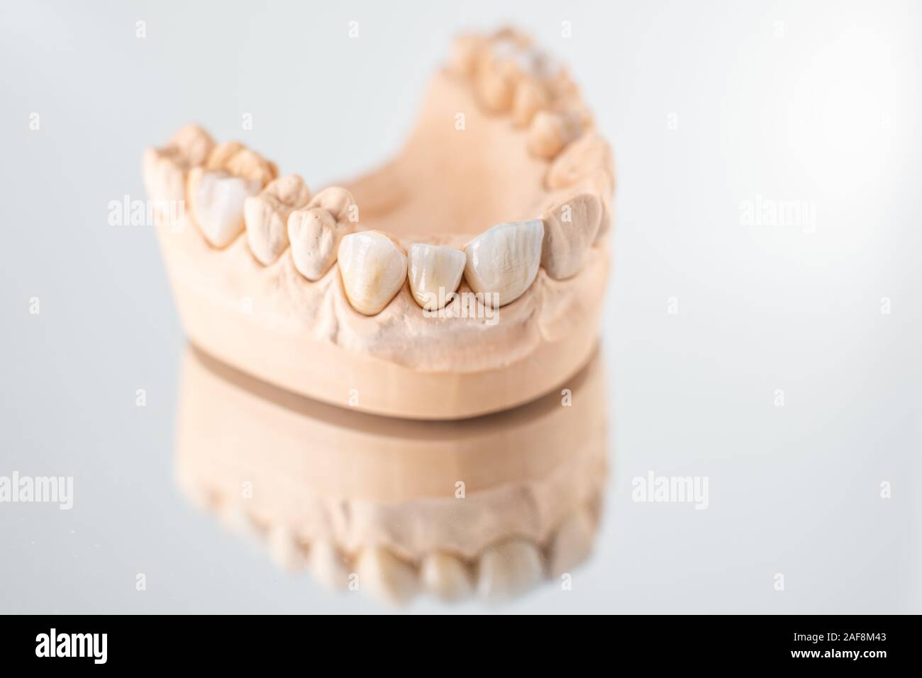 Close-up on plaster model of artificial jaw with veneers on the mirror ...