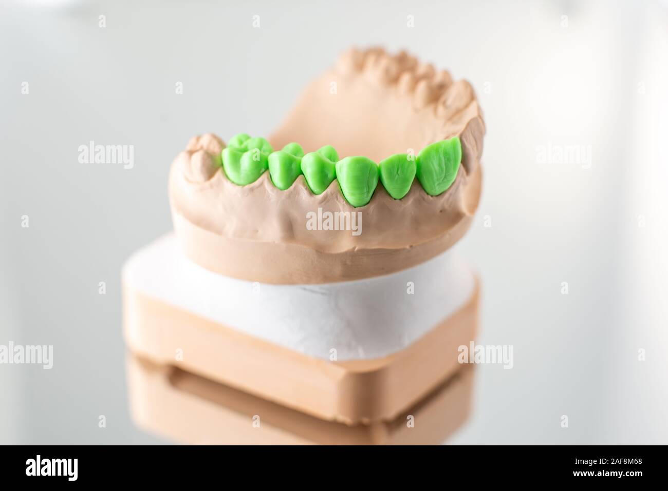 Close-up on plaster model of artificial jaw with teeth painted in green ...