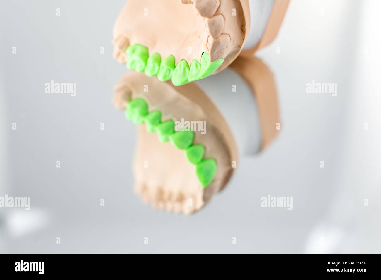Close-up on plaster model of artificial jaw with teeth painted in green ...