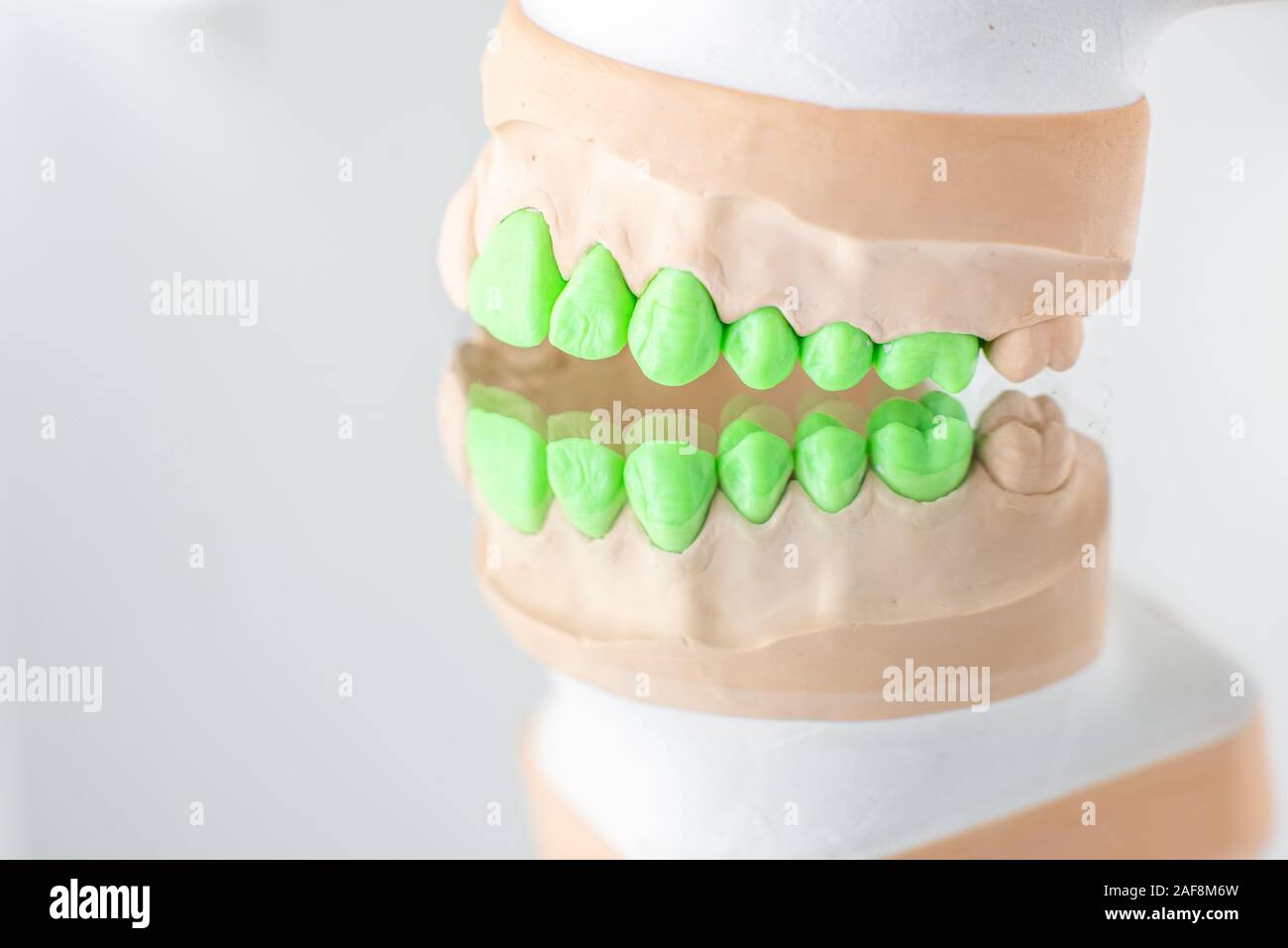 Close-up on plaster model of artificial jaw with teeth painted in green ...