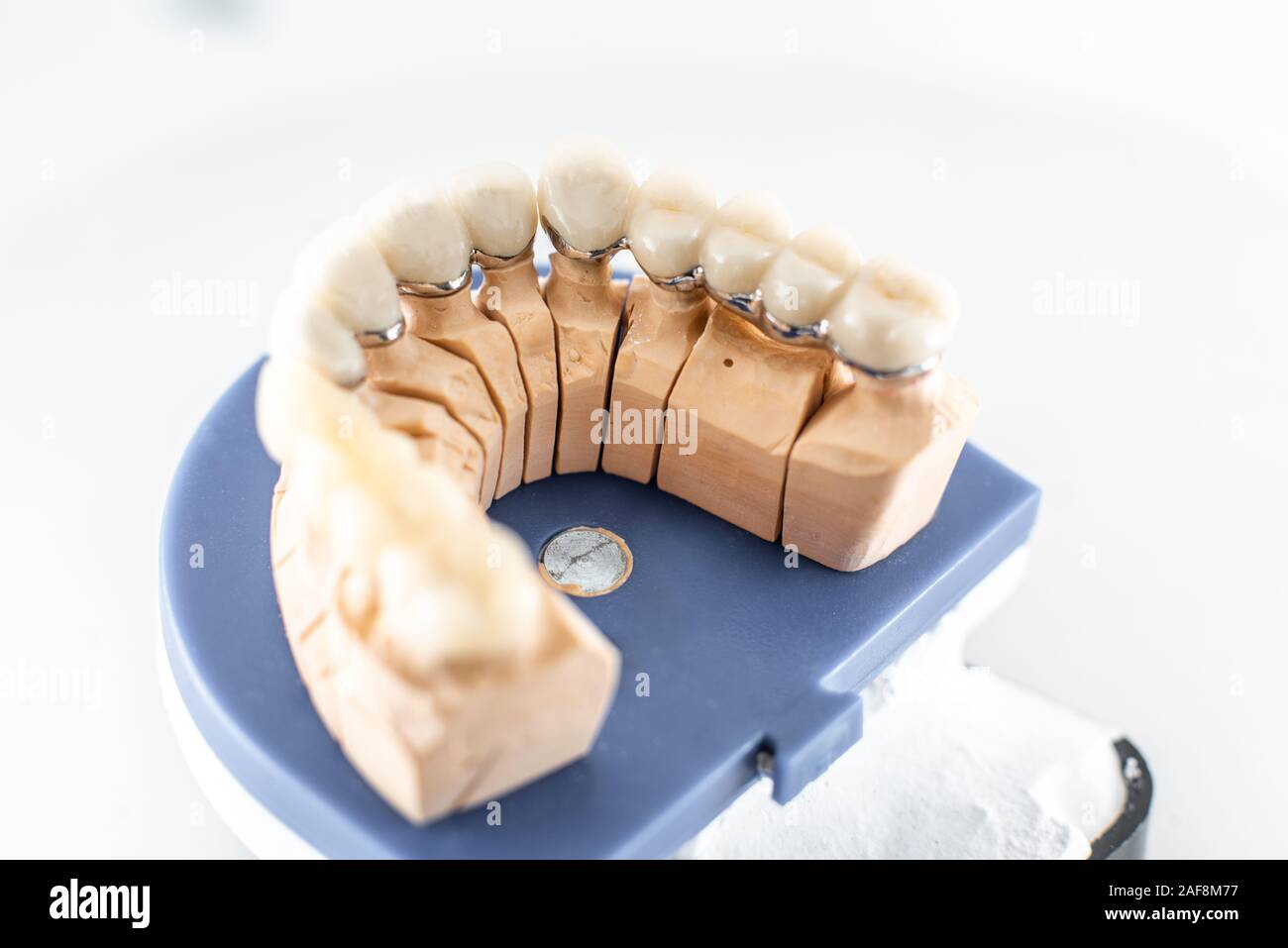 Cose up studio shot of dental imprint with artificial teeth on a dental laboratory workbench. Artificial teeth modeling concept Stock Photo