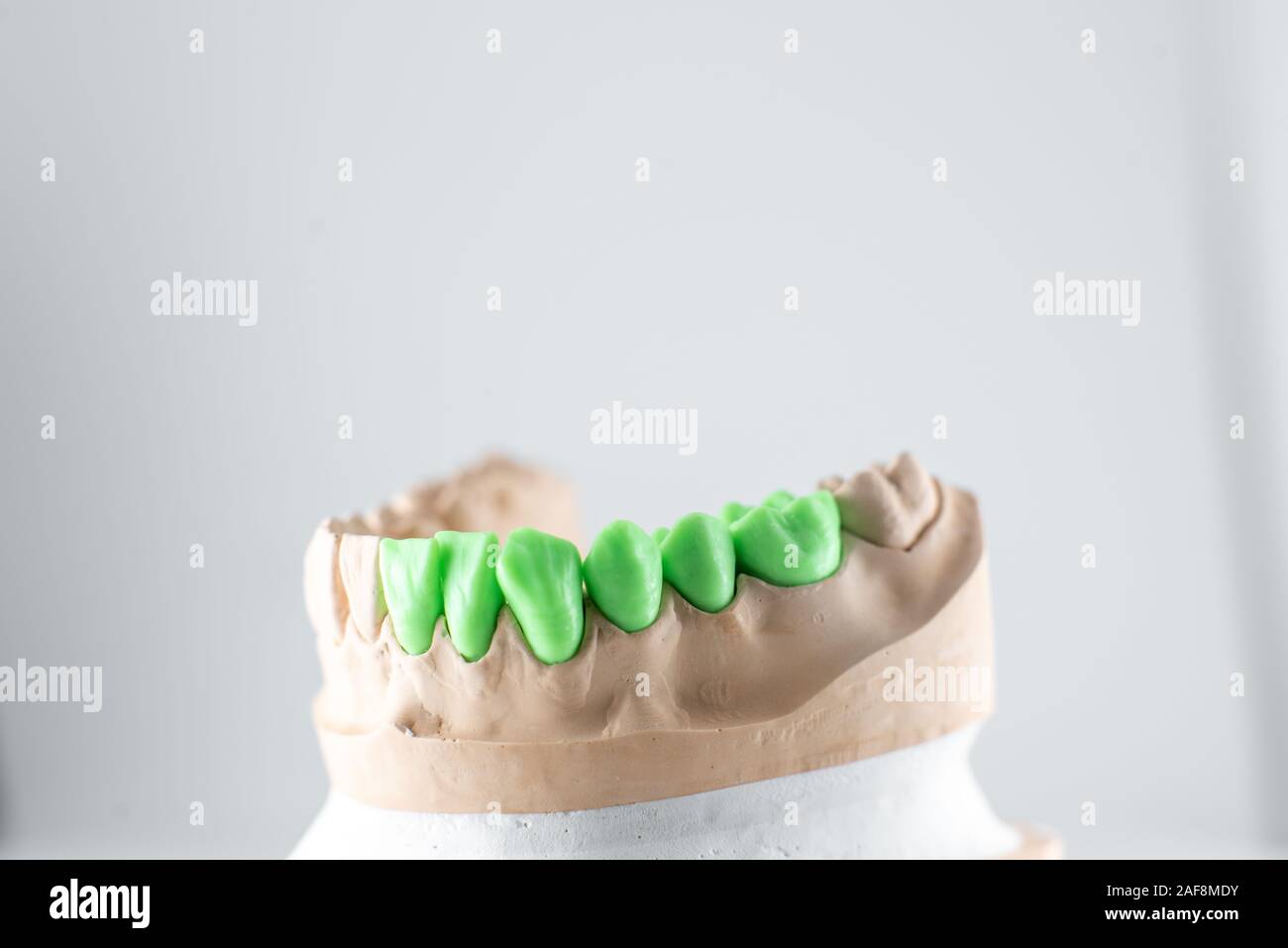 Close-up on plaster model of artificial jaw with teeth painted in green ...