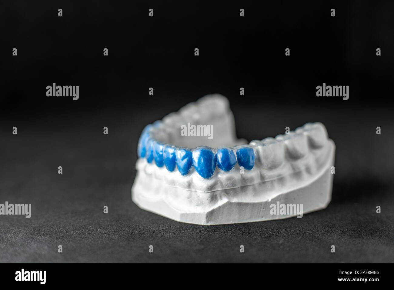 Close-up on plaster model of artificial jaw with teeth painted in blue ...