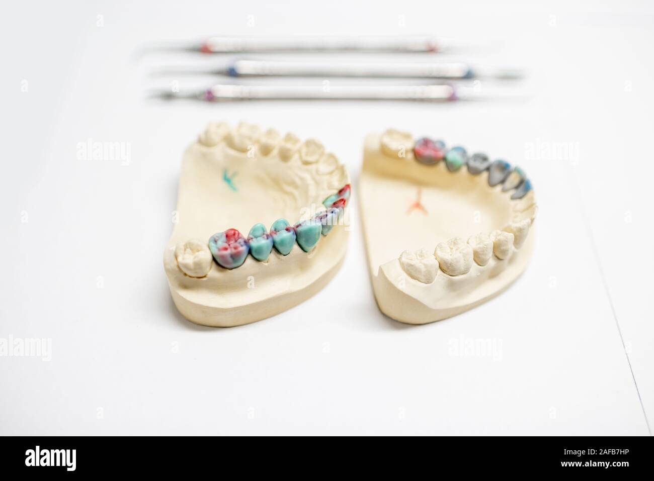 Plaster models of artificial jaw with painted dental prosthesis on the ...