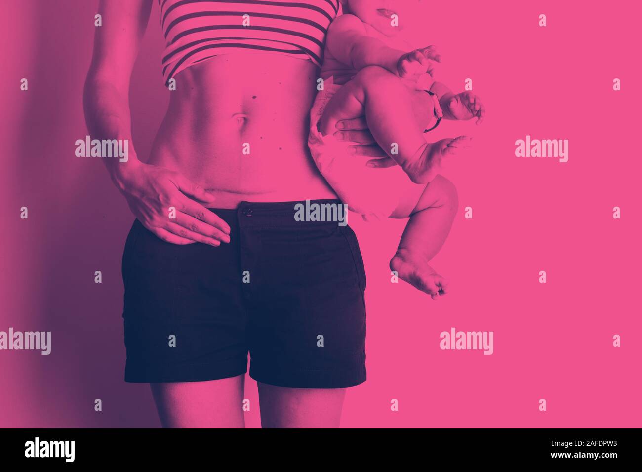 C section Cesarean operation heal after mother holding baby postpartum recovery duotone Stock