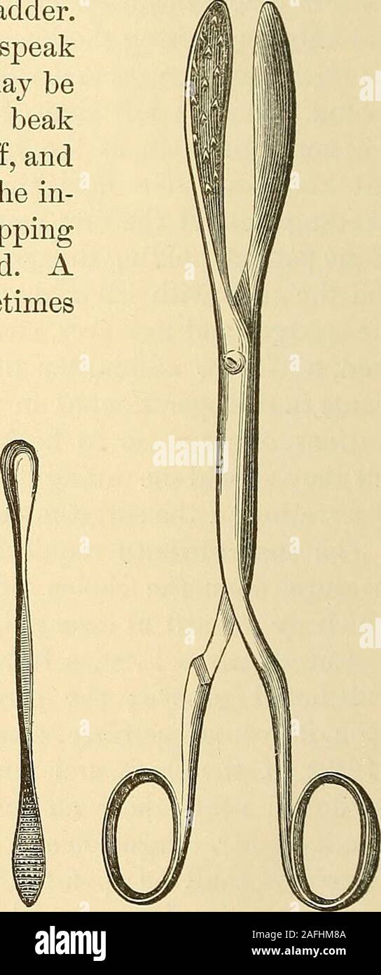 . The principles and practice of surgery. Straight Lithotomy Curved Lithoto-Forceps. my Forceps. Scoops. Large Serrated Lithotomy For-ceps. used, which, like Dupuytrens double lithotome cache, cuts only whilethe instrument is being withdrawn from the bladder. LITHOTOMY BY OBLIQUE INCISION. 847 Fig. 426. In addition, the surgeon should be supplied with Physicks artery for-ceps ; a large syringe; a silver canula, or an ordinary female silvercatheter covered, except at its two extremities, with a muslin shirt orsac, closed upon the catheter just above its eye, and open at the top.This latter is a Stock Photo