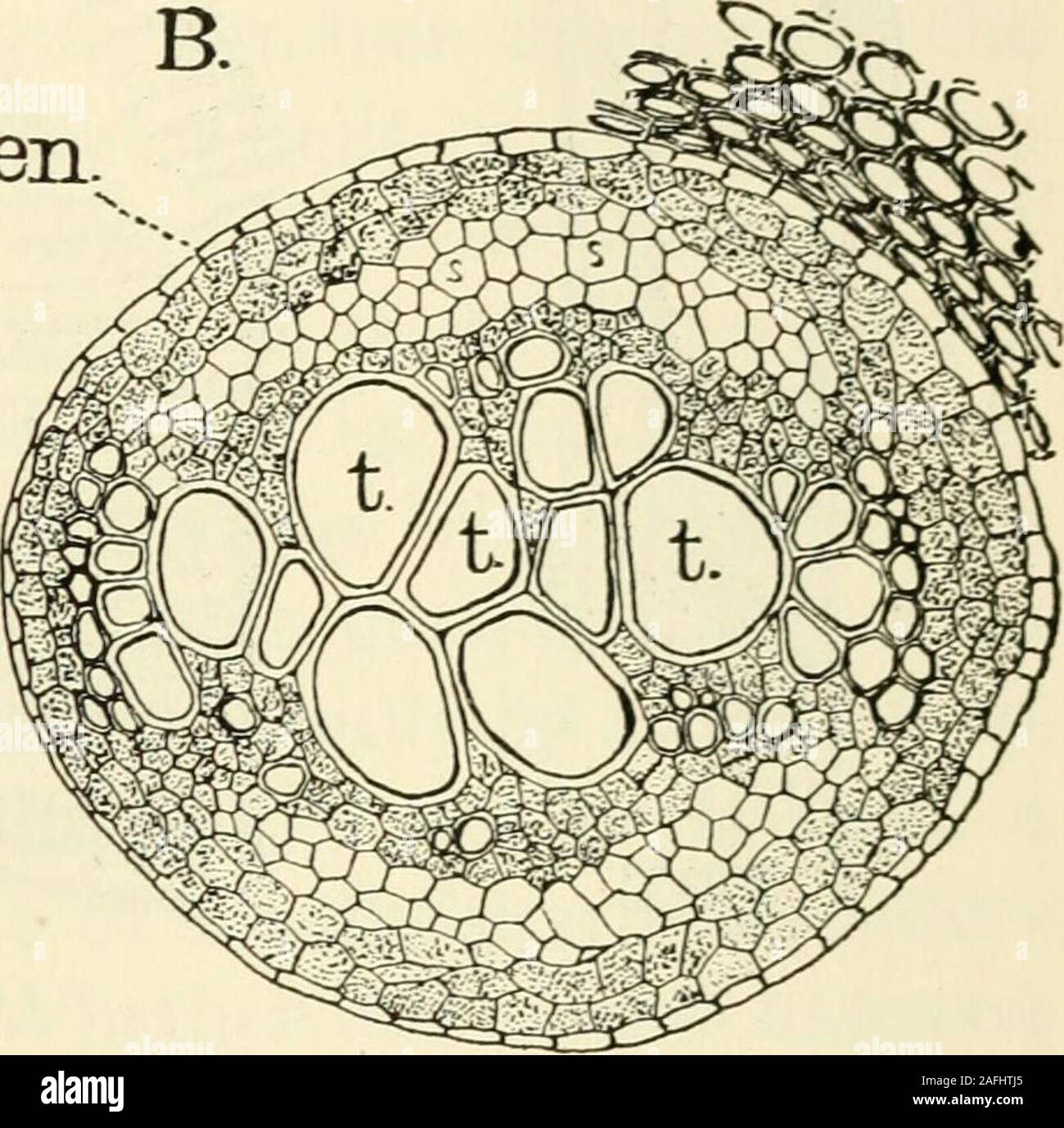 Tracheids Cross Section