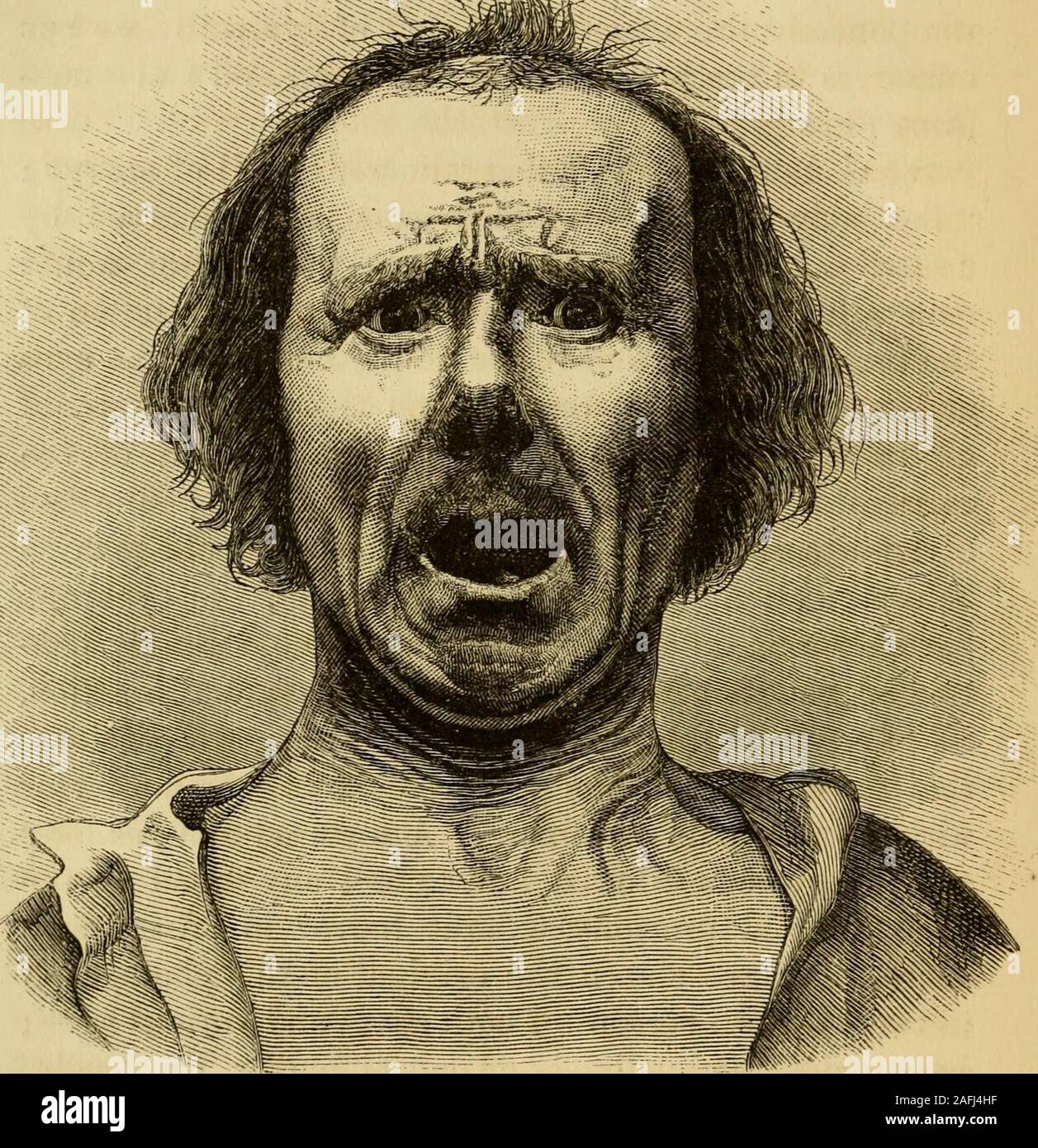 Tortured expression hi-res stock photography and images - Alamy