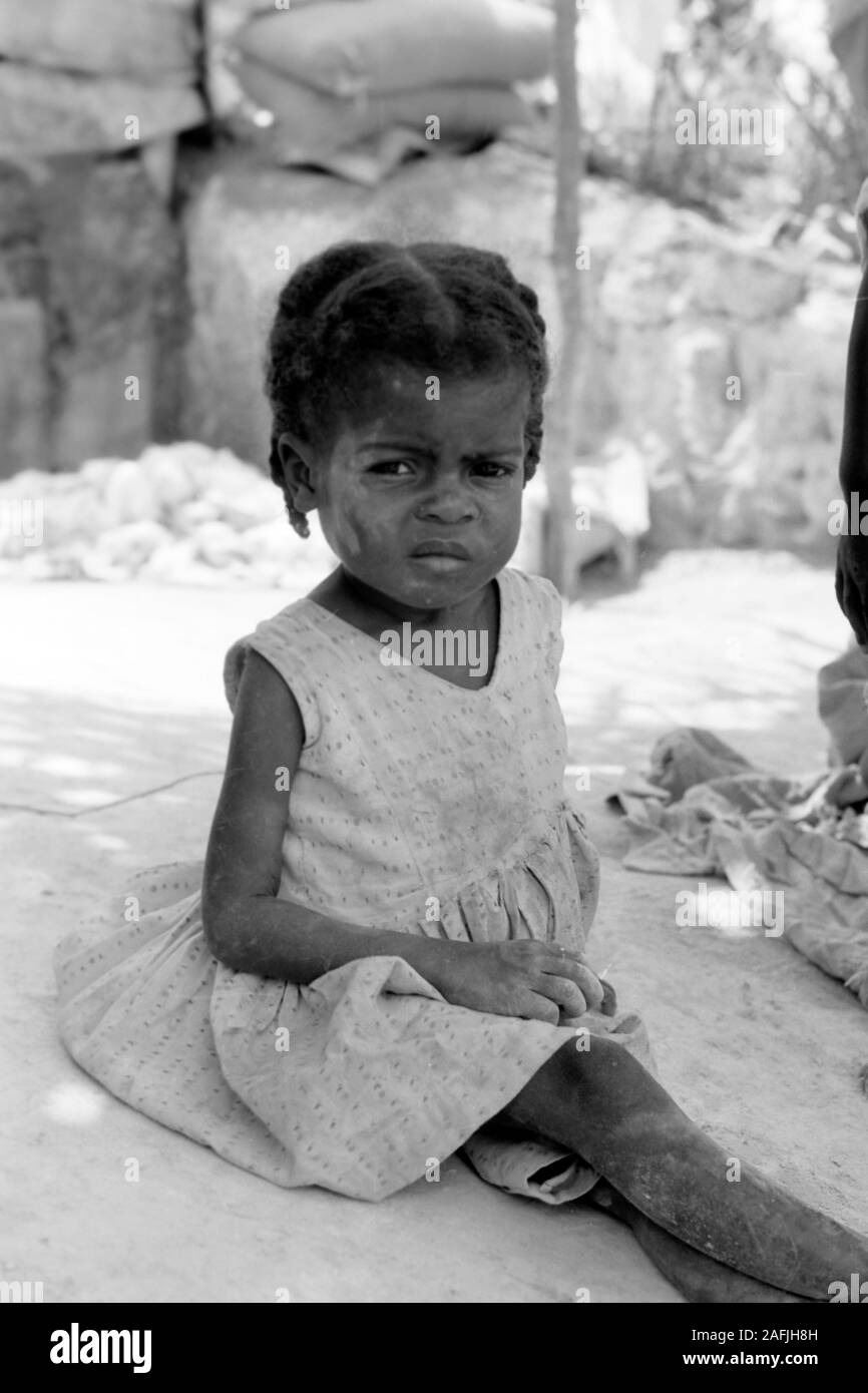 Malariakrankes Kind, 1967. Child suffering from malaria, 1967. Stock Photo