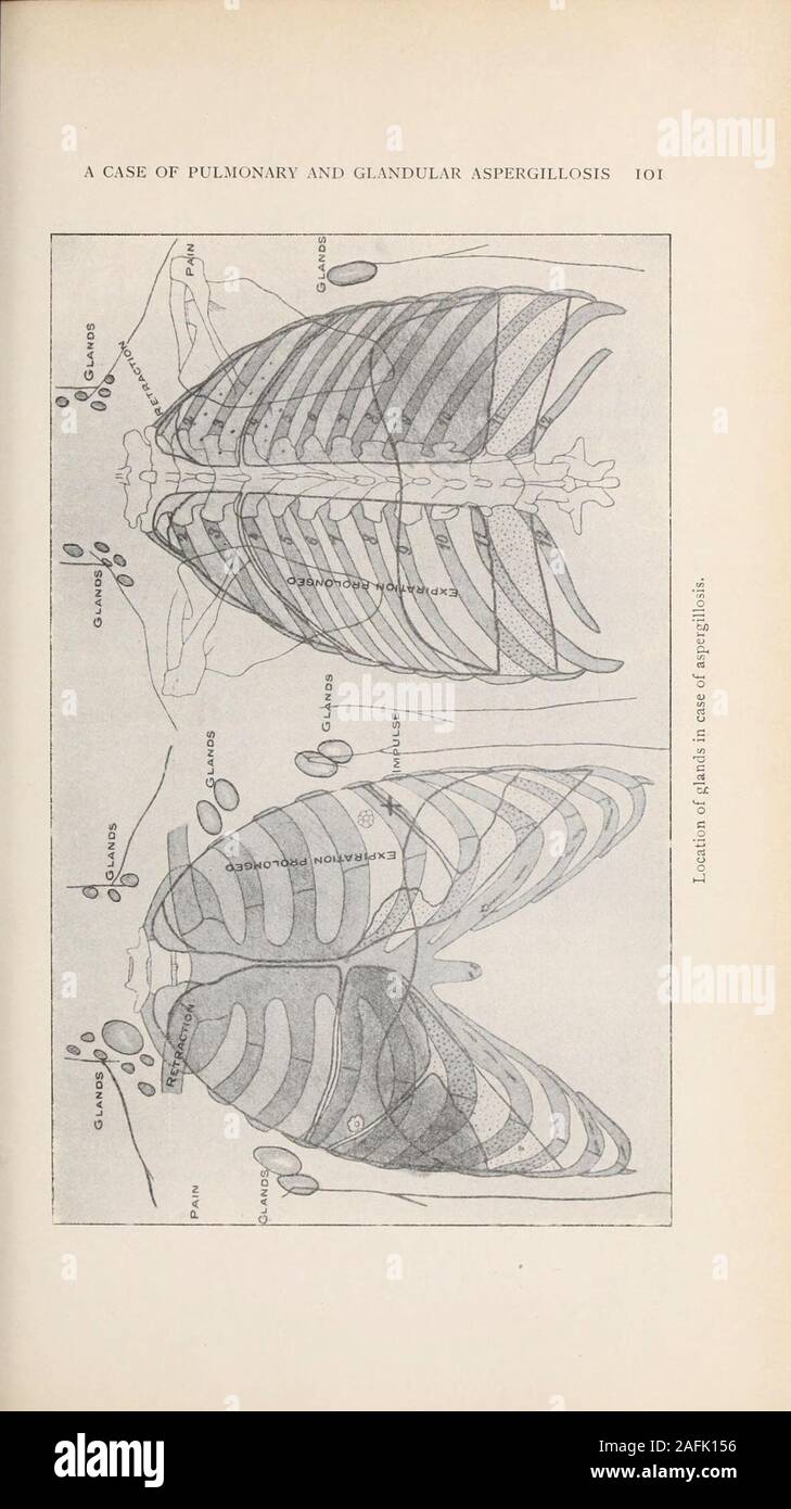 Flushed skin hires stock photography and images Alamy