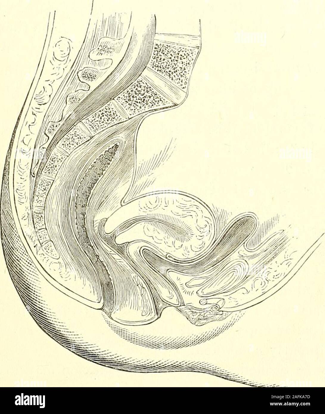 Uterine Wall High Resolution Stock Photography And Images Alamy