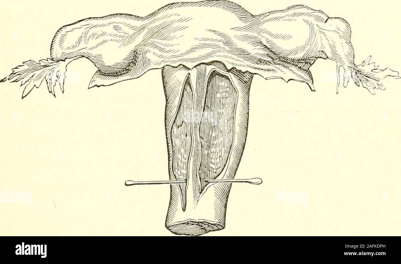 The diagnosis, pathology and treatment of diseases of women