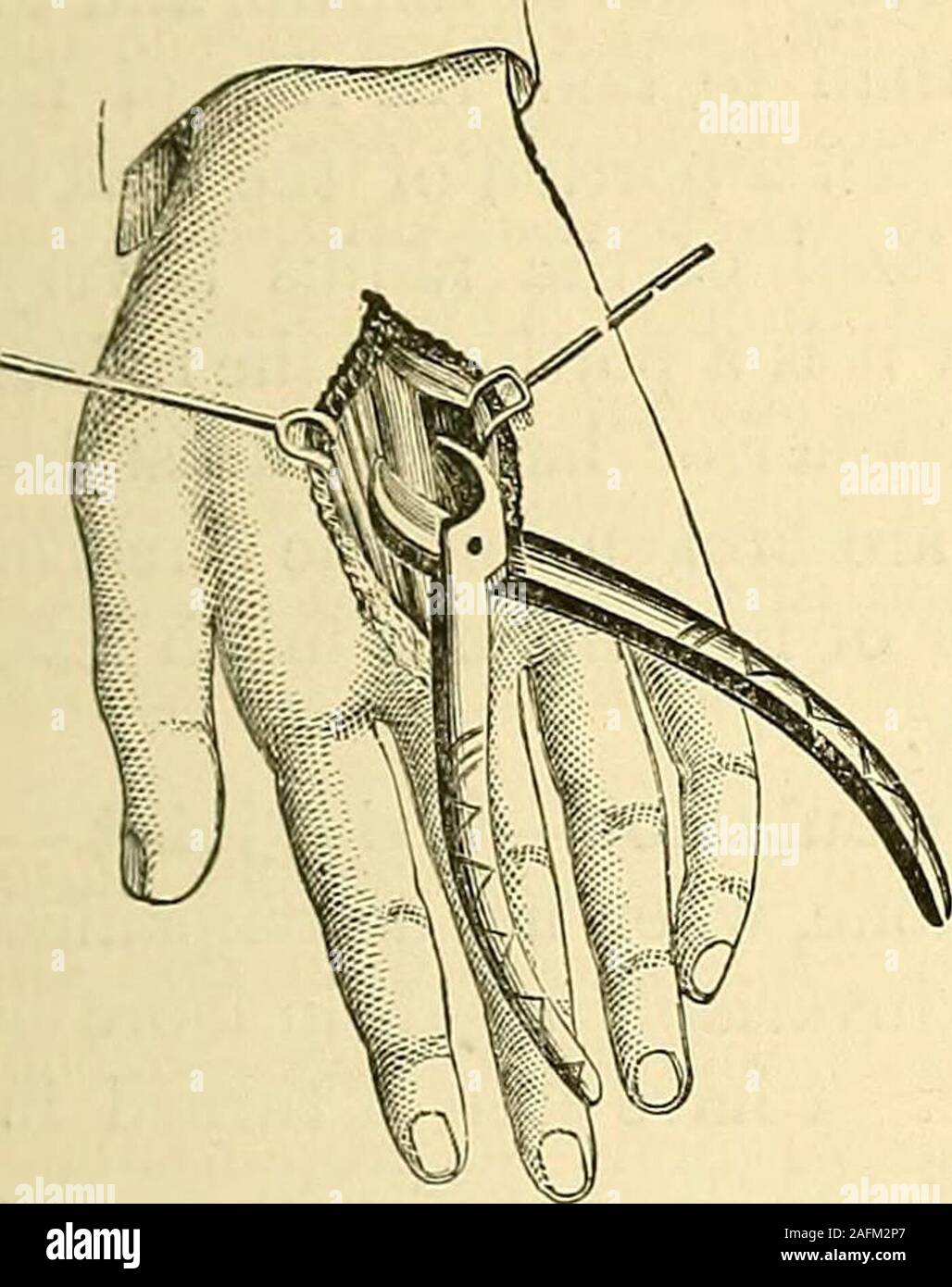 . The principles and practice of surgery. carpal bones may be removed ...
