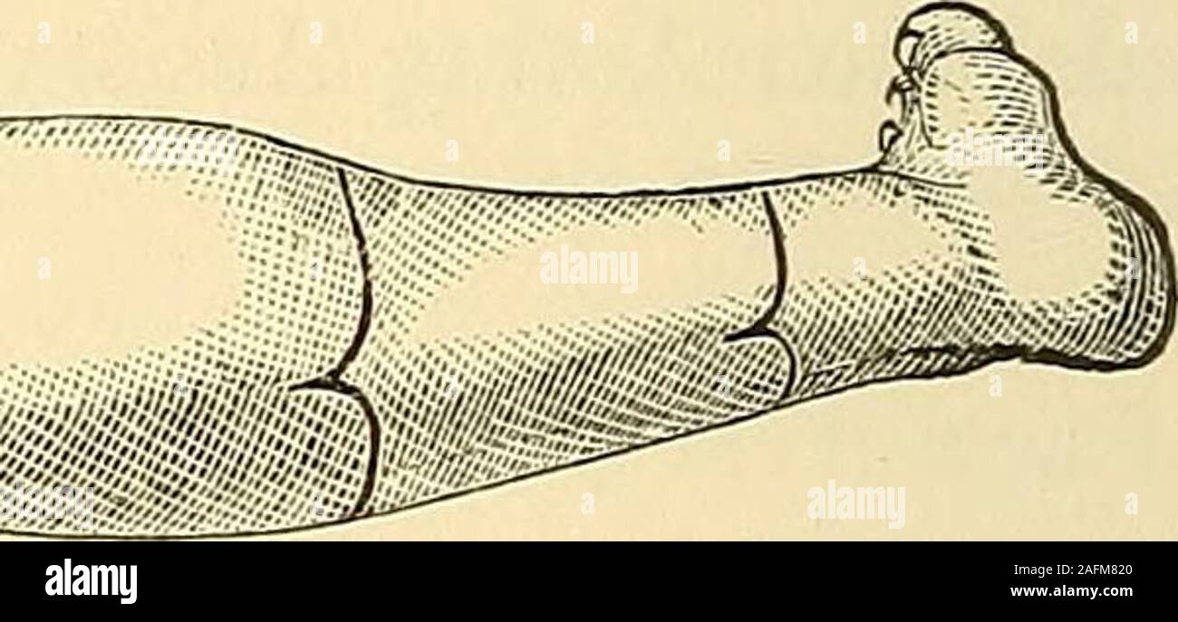 . The principles and practice of surgery. ower third of theleg the ...