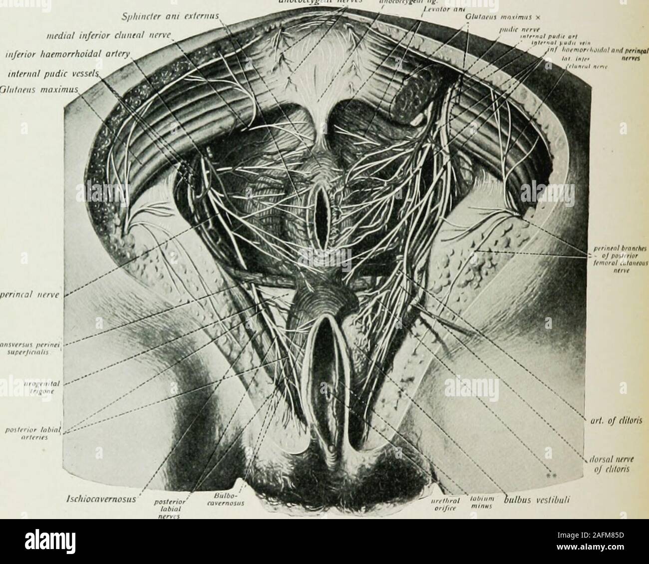 Pareunia . Local and regional anesthesia : with chapters on spinal, epidural ...
