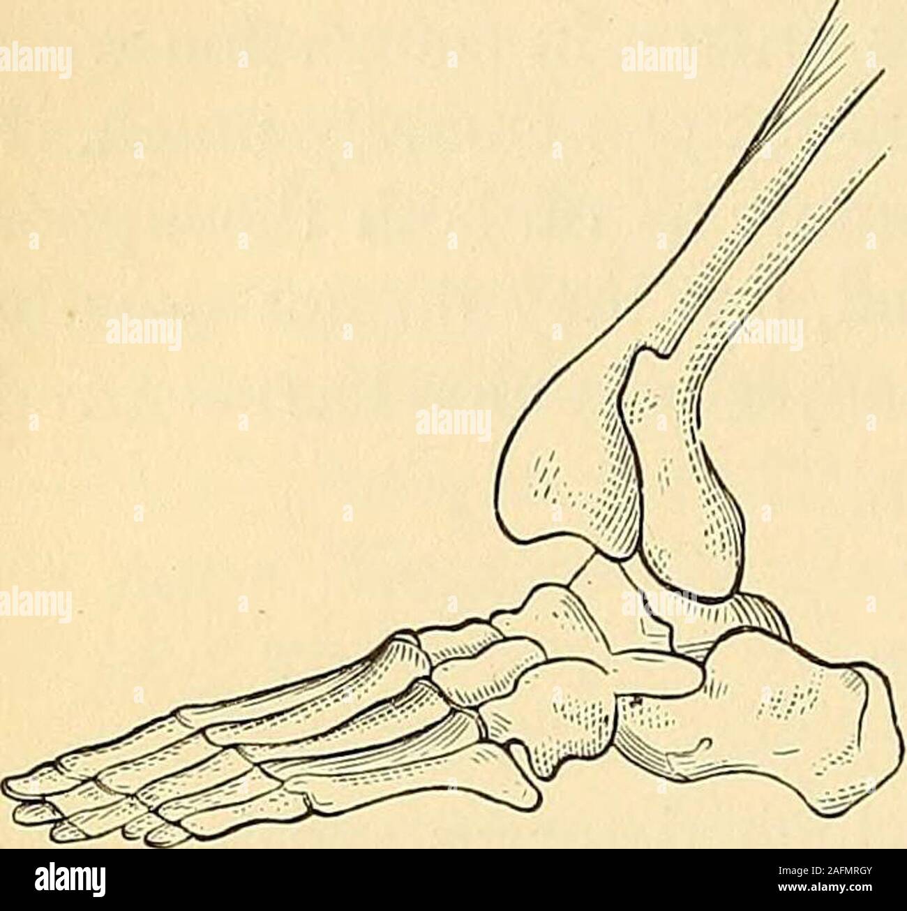 Tibia splint hi-res stock photography and images - Alamy