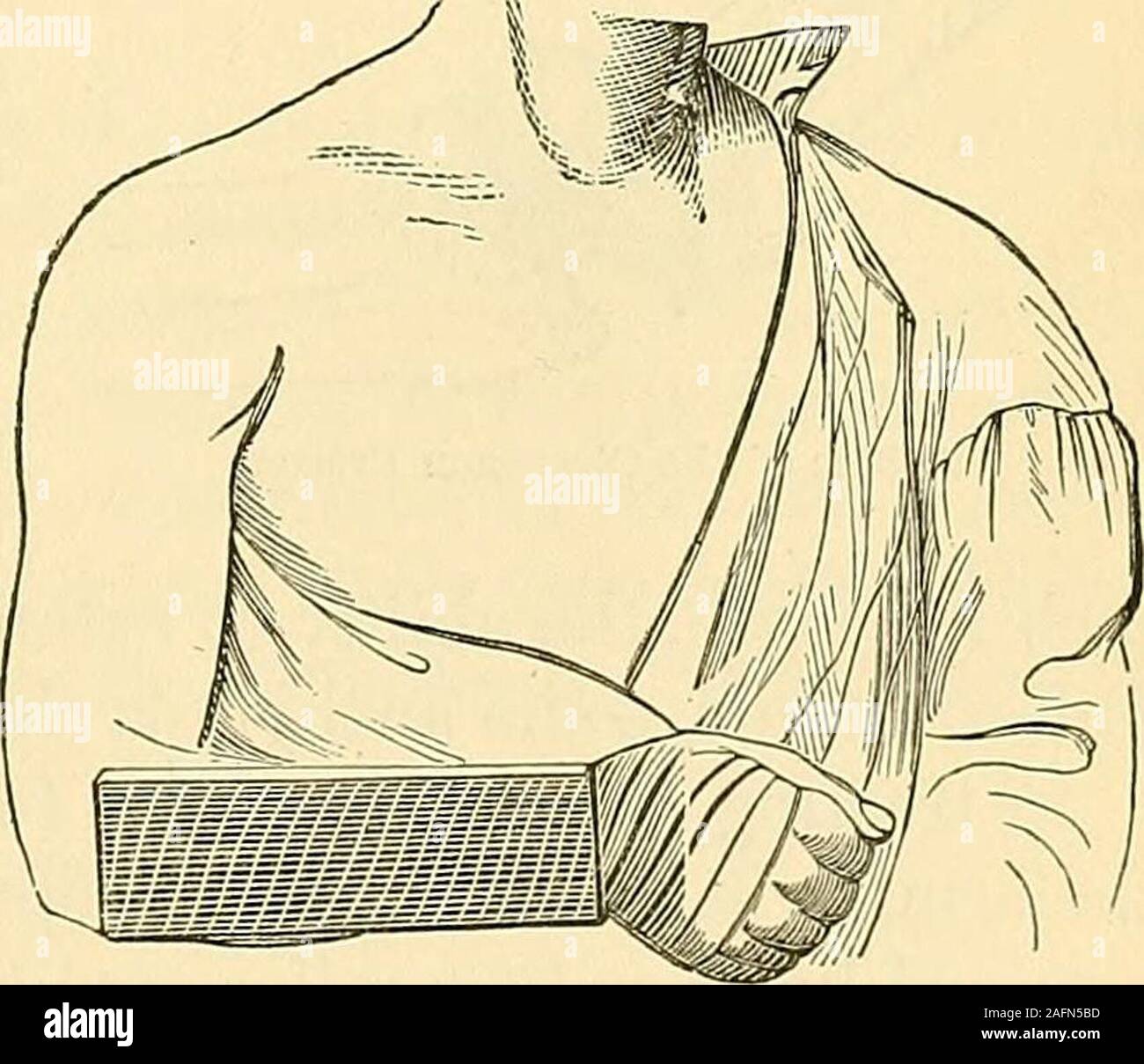 . The principles and practice of surgery. The authors Pistolshaped