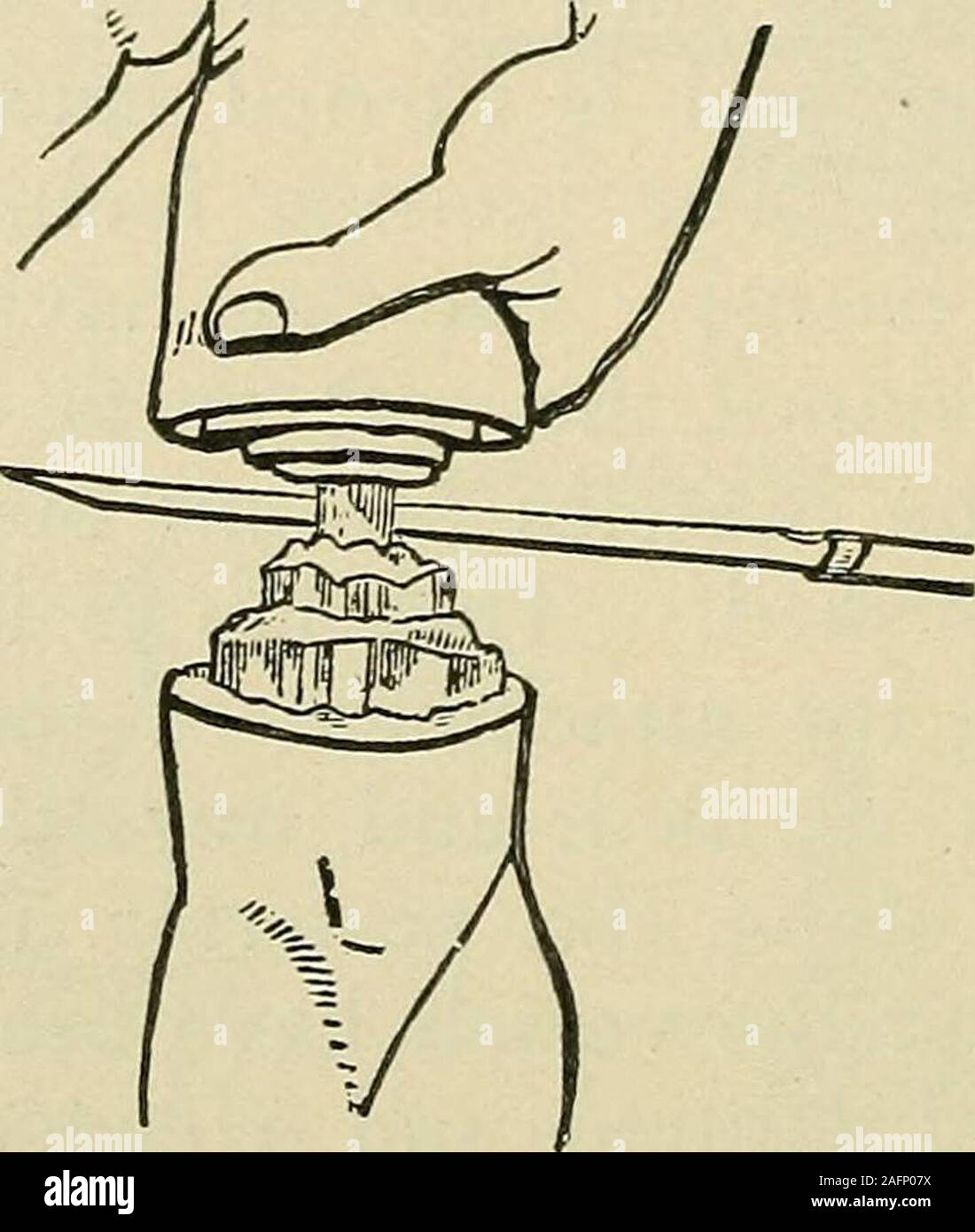 . Minor surgery and bandaging; including the treatment of fractures and ...