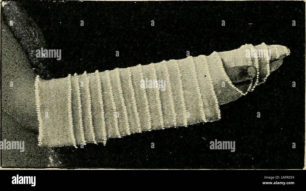 . Minor surgery and bandaging; including the treatment of fractures and ...