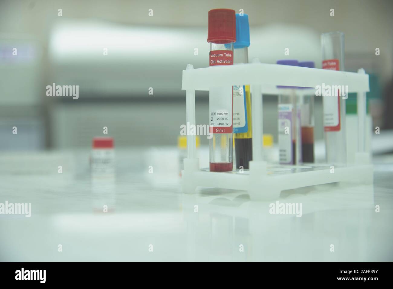 many test tubes with blood being tested Stock Photo Alamy