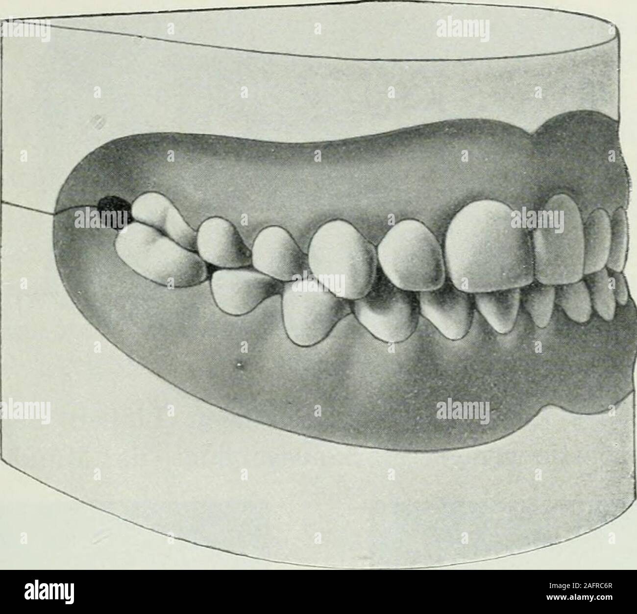 Lehrbuch Der Orthodontie Fur Studierende Und Zahnartze Mit Enschluss Der Geschichte Der Orthodontie Fi 294