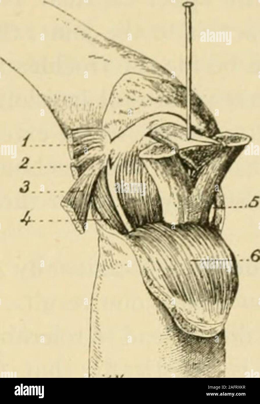 . Manual of operative surgery. Fig. 1370. Fig. 1371. Figs. 1370 and ...