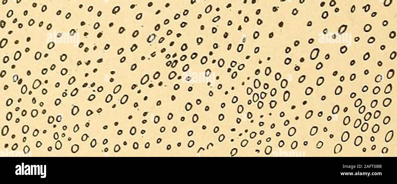 Urinary Analysis And Diagnosis By Microscopical And Chemical Examination 0 Ooo 0 Eo V