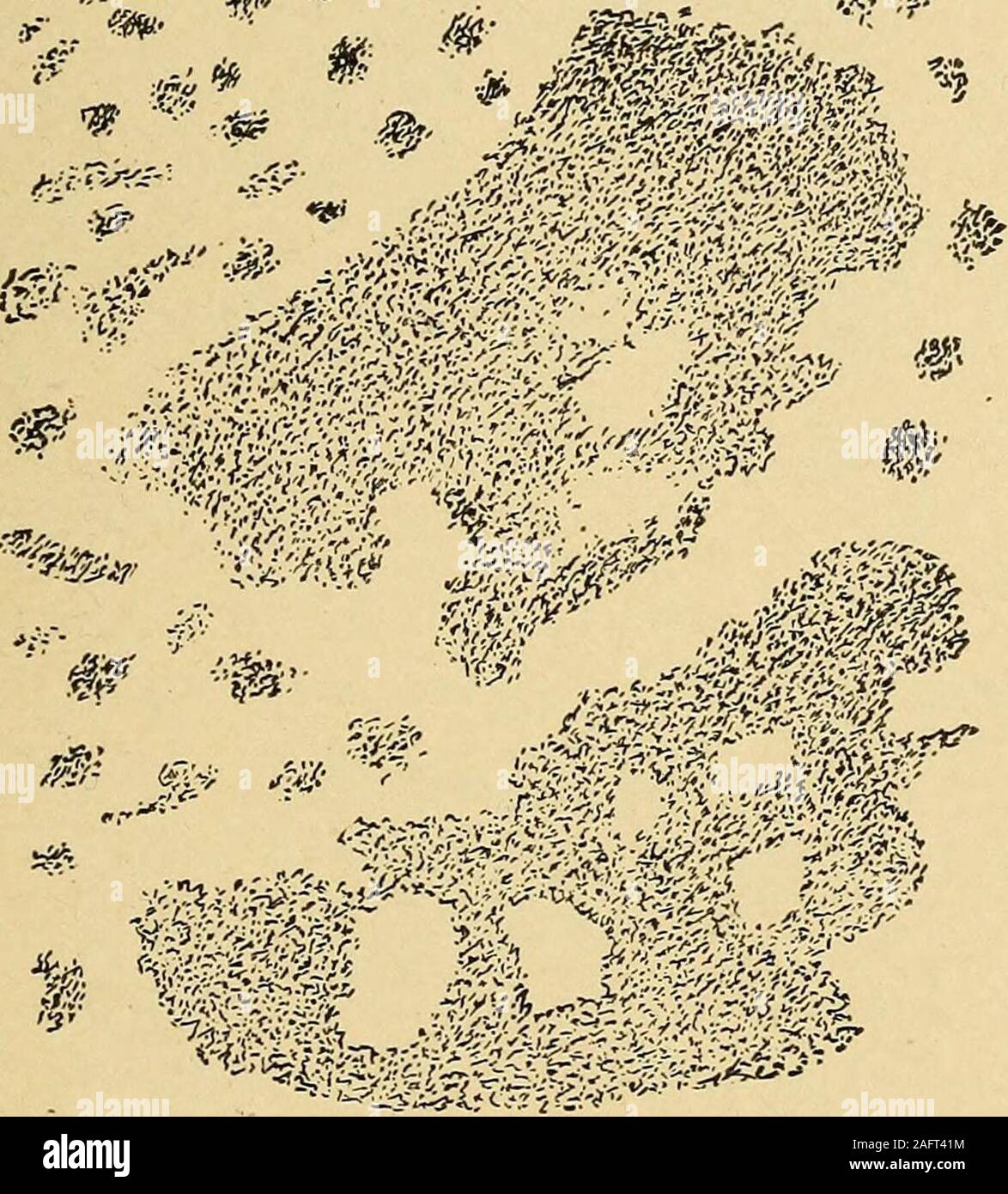 Sodium urate crystals hires stock photography and images Alamy