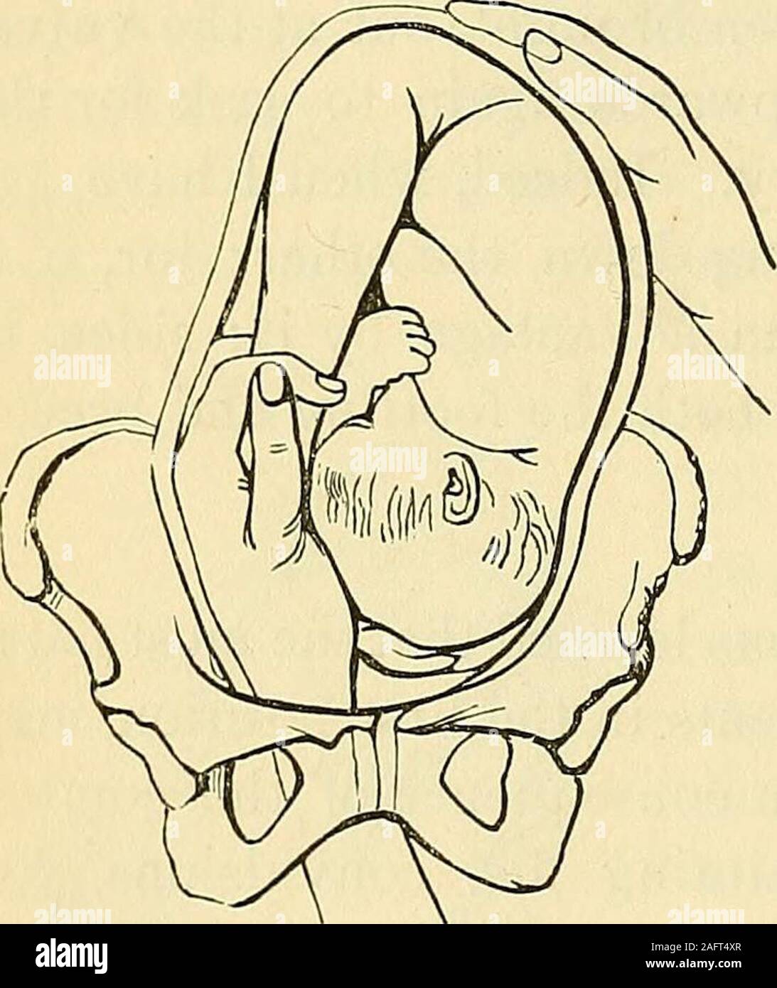 . Obstetrics: the science and the art. himlook at the figure, and he ...