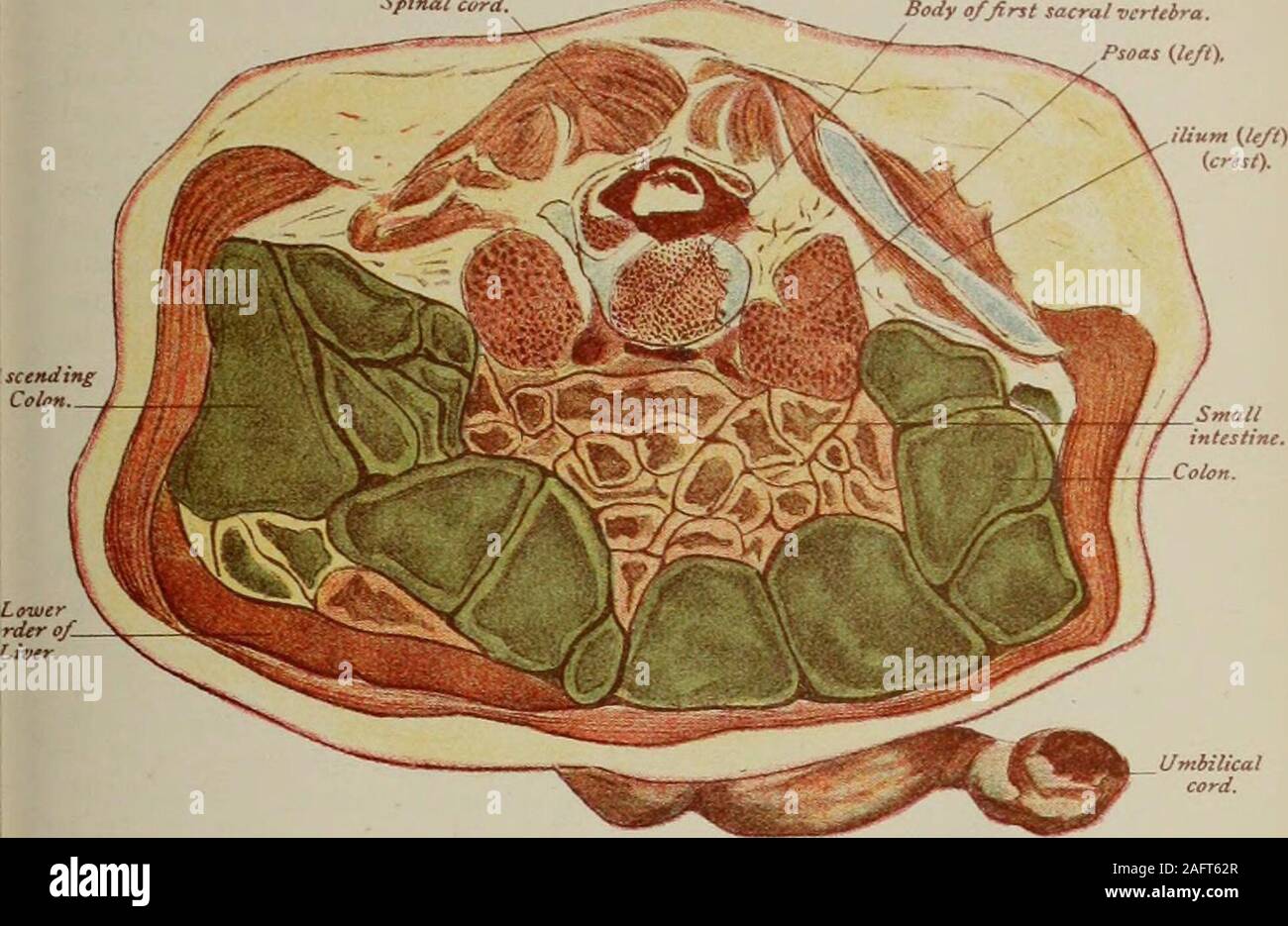 Small intestine second part hi-res stock photography and images - Alamy