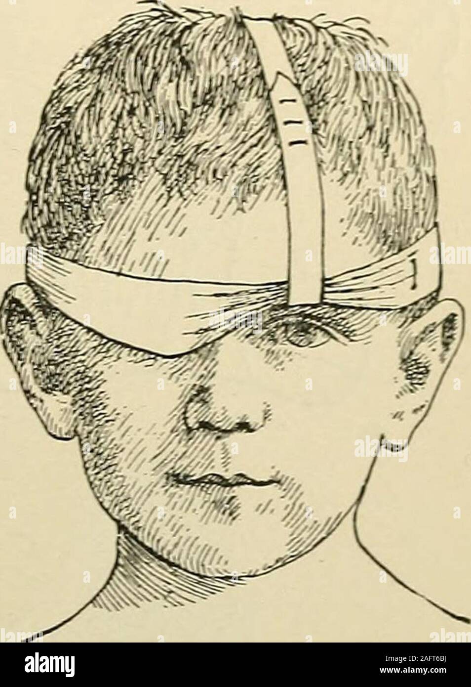 . Minor surgery and bandaging; including the treatment of fractures and