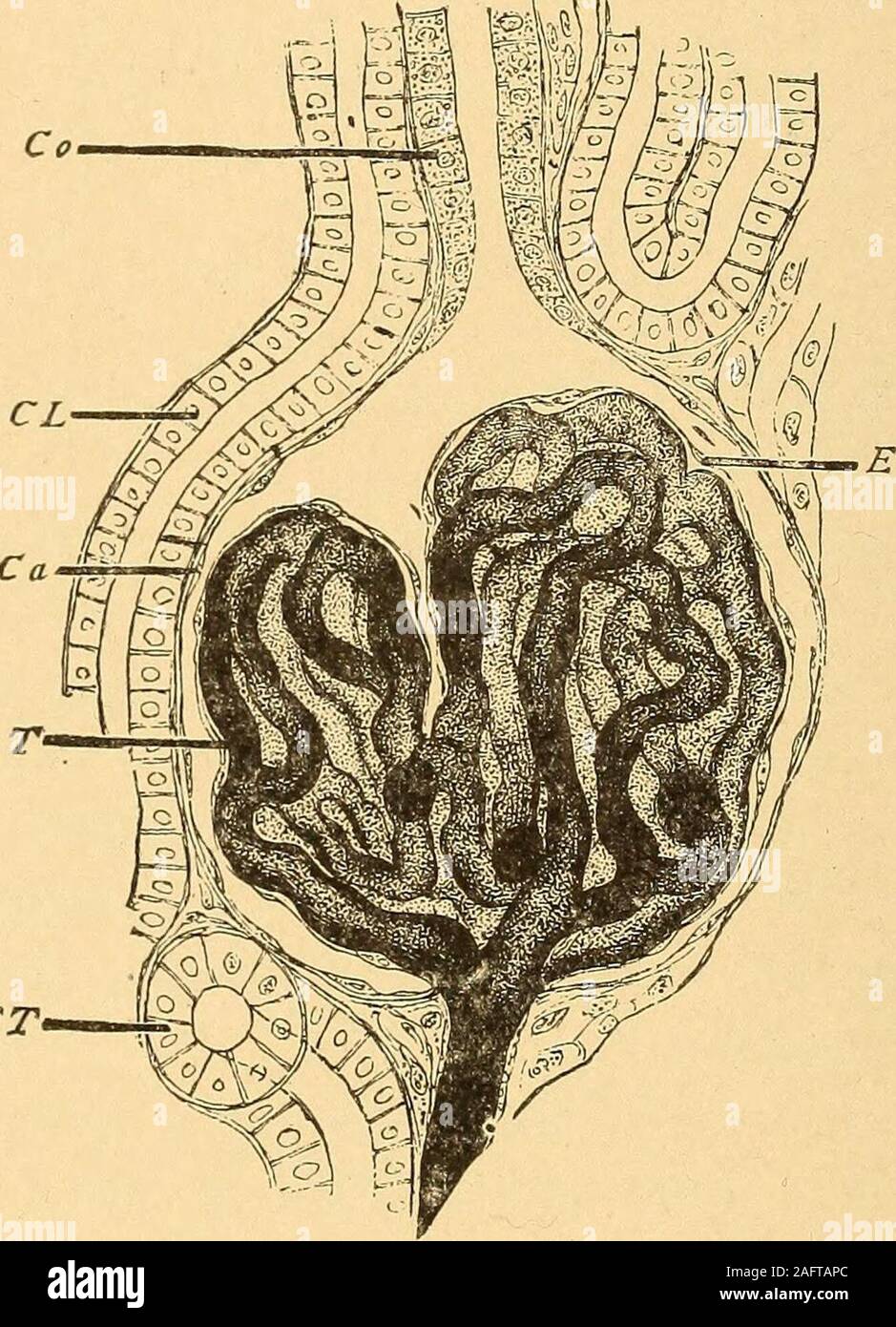 . Urinary analysis and diagnosis by microscopical and chemical examination. tis 265 Hemorrhage from the Bladder, Due to Papilloma of Bladder 269 Villous Cancer of the Bladder .273 Acute Abscess of the Prostate Gland 279 Chronic Prostatitis 281 Chronic Prostatitis, with Hypertrophy of the Prostate Gland .... 285 Chronic Spermatocystitis, or Seminal Vesiculitis 289 Hemorrhage from Seminal Vesicles, with Acute Prostatitis . . .291 Chronic Catarrhal Vaginitis 295 Ulcerative Vaginitis 297 2 URINARY ANALYSIS AND DIAGNOSIS. The proximal convoluted tubule originates from the capsule of Bow-man as a sl Stock Photo