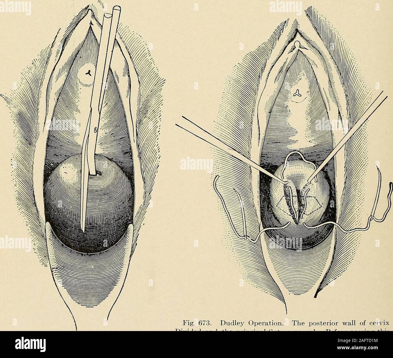 Dilator anwendung