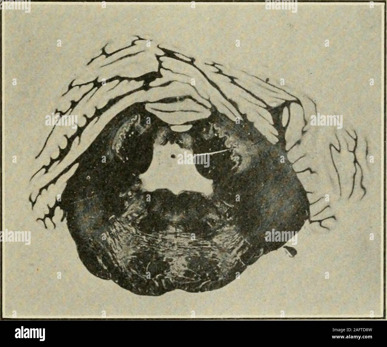 . The Journal of nervous and mental disease. Fig. 8. Section through the anterior extremity of the right corpus den-tatum and the trigeminal level of the pons. Peculiar asymmetry of the hemi-spheral lobules. bundle. The accessory olivary bodies, the nuclei of the lateralcolumns, the arcuate nuclei and the antero-external and postero-external arcuate fiber systems as well as the nuclei of the posteriorcolumns are all perfectly normal. At the lateral margin of thelower medulla on both sides the domain of the dorsal spino-cere-bellar tract is less deeply stained than the surrounding white matter, Stock Photo