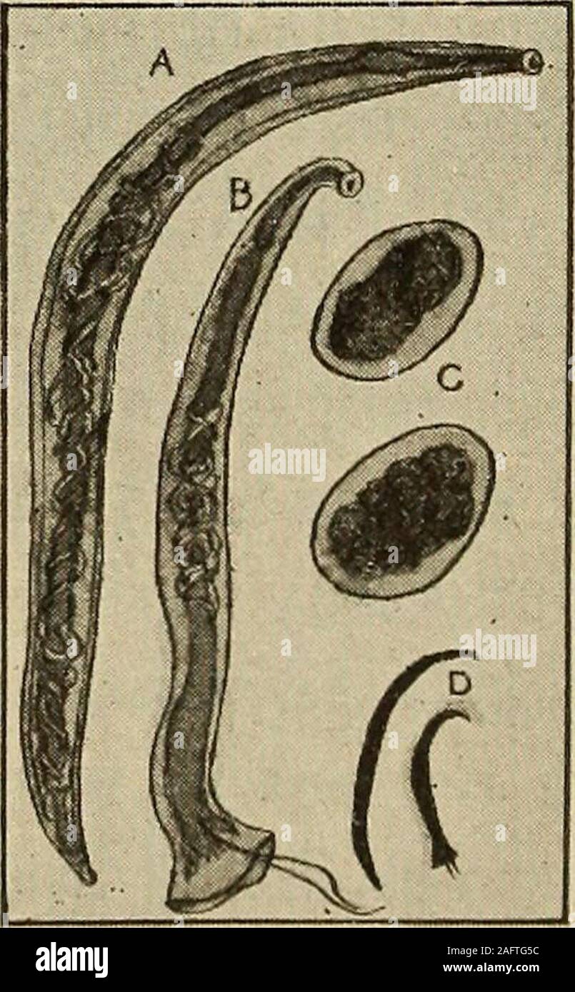 Medical Diagnosis For The Student And Practitioner Fig 560 Ankylostomiasis Re Tarded Development And Typical Fadesin A Young Man After Carter Fig 561 Uncinaria Ankylostoma Duoden Ale A Female B Male C Eggs D Male Andfemale Showing