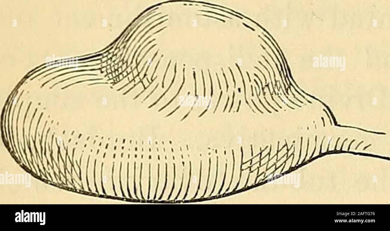 . Obstetrics: the science and the art. usand careful microscopic examinations of the ovarian stroma havenot exhibited to me any evidences of the aciniferous nature of thatsubstance ; wherefore I am the more inclined to adopt the opinion ofthe cytoblast character of the germ point. 250. The Corpus Luteum.—Before I conclude my remarksupon the ovary, I ought to say something on the subject of the cor-pus luteum, a topic that has elicited an immense amount of discus-sion, and which still, perhaps, must remain a vexed question. Per-haps the principal interest that society has in the settlement of t Stock Photo