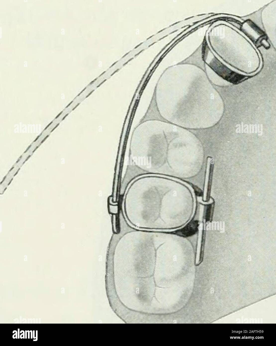 Lehrbuch Der Orthodontie Fur Studierende Und Zahnartze Mit Enschluss Der Geschichte Der Orthodontie R Anwendung Kommt