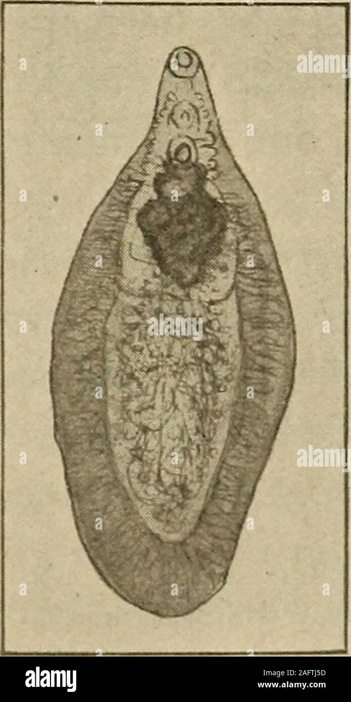 . Medical diagnosis for the student and practitioner. Fig. 551.—Male {a) and female (6) ofBilharzia hemalobia. {After Looss.) Fig. 552.—Fasciola hepatica. Symptoms.—The foregoing description indicates the seat, diverse nature,and variety of symptoms, which are of course chiefly those of hematuria,abscesses, and irritation of the. urinary tract, dysenteric stools, rarely Glis-sonian cirrhosis and a varying degree of anemia. The diagnosis depends uponthe finding of the characteristic eggs. The Fasciola hepatica or Distomum hepaticum of sheep, a small fluke, 1154 MEDICAL DIAGNOSIS measuring 20 to Stock Photo