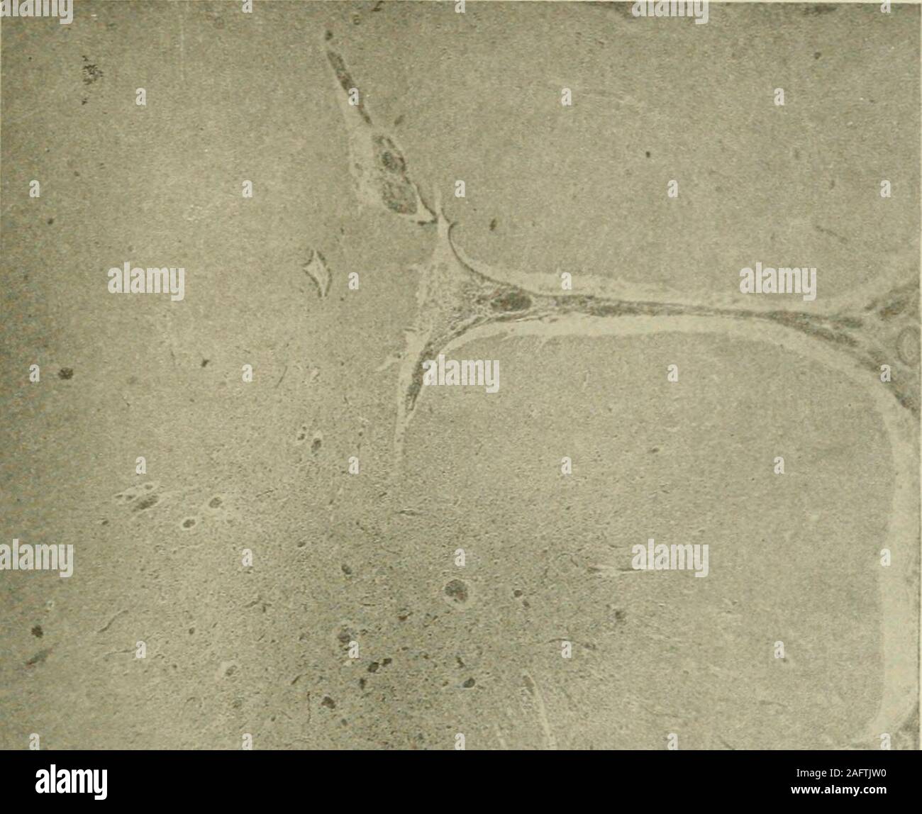 Cerebral cortex nerve cells hi-res stock photography and images - Alamy