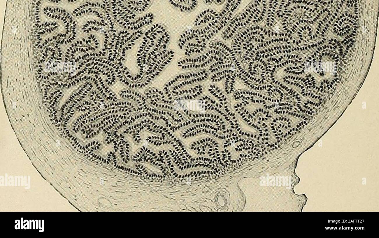 . The diagnosis and treatment of diseases of women. Fig. 630. Cross Section of the Fallopian