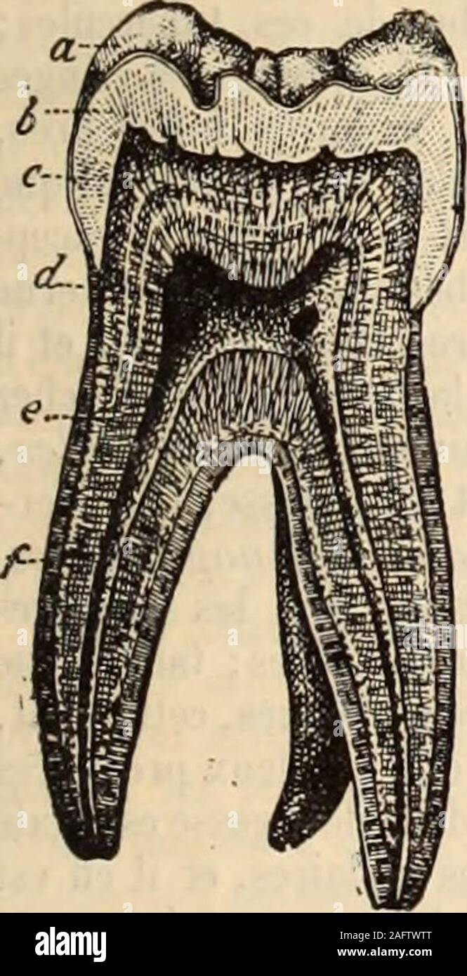 Il A La Dent Dure En 6 Lettres La Grande encyclopédie, inventaire raisonné des sciences, des lettres et  des arts. ès riche en vaisseaux et en nerfs.La portion dure, la dent  proprement dite, est constituéepar trois substances : lune
