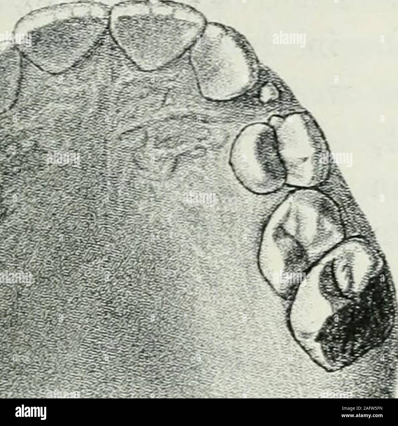 . Lehrbuch der orthodontie fur studierende und zahnartze mit enschluss der geschichte der orthodontie. Fig. Fig. 75. Beides ist sicher nur durch die Extraktion der sechsjährigenMolaren erreicht. Hier ist die Extraktion der ersten Molaren durch nichtsgerechtfertigt, da die letzteren nur unbedeutend kariös sind. Wenn einmal extrahiert werden sollte, dann lieber doch dieersten Prämolaren, da hierdurch genügend Platz für eine bessere I. Prophylaktische Maßregeln. 123 Stellung aller Zähne besonders der Frontzähne geschaffen undein lückenloses Aneinanderreihen aller Zähne gesichert war.Auf die Weish Stock Photo