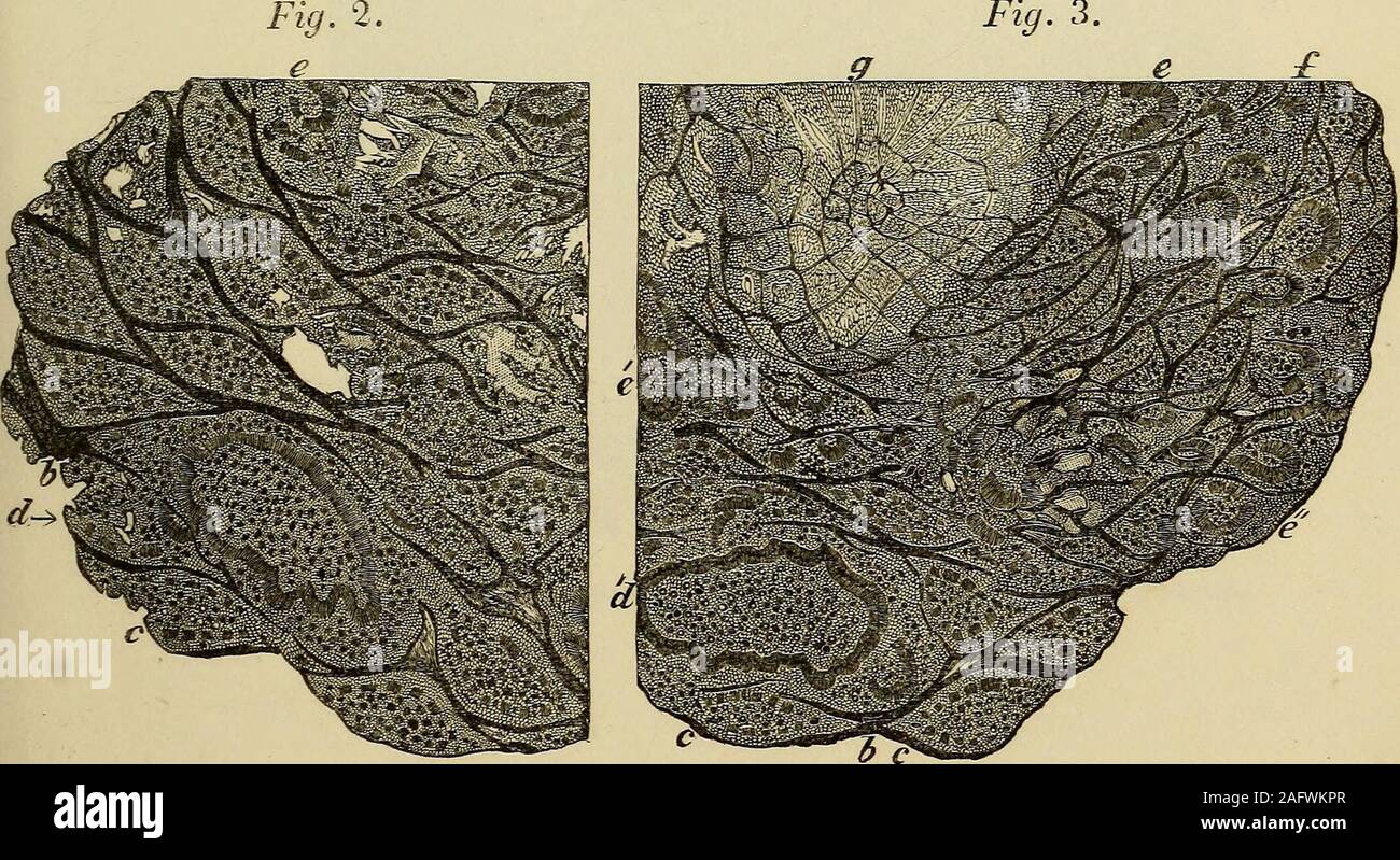 . Geology and mineralogy considered with reference to natural theology. Trunk of Cycadites Microphyllus with buds in the axilla of the Petiolesfrom I. Portland. Scale . Fig. 3. --^.-jC- -?,-?-- szp???- &gt;*•?• .. Sections of Buds and Petioles of Cycadites Microphyllus from I. Portland. Nat. size. PL 62. Stock Photo