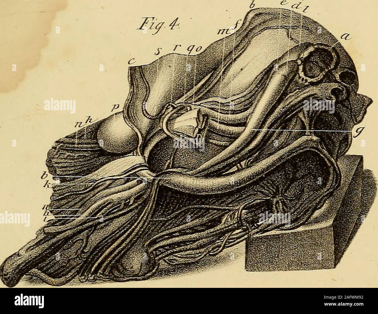 . The anatomy and surgical treatment of abdominal hernia. IT French, del. inndalrs Llth EXPLANATION OF PLATE XIX. 413 q. Common trunk of the epigastric and obturator arteries. r. Obturator artery passing before and on the inner side ofthe neck of the sac, in its course to the obturator fora-men, and situated a little above the posterior edge of theexternal oblique muscle. s. Epigastric artery. An engraving of this preparation has been published in an in-genious Thesis on Crural Hernia, by Dr. James Sanders, Edin-burgh, 1805. PLATE XX. Shows three umbilical herniae, one of which is curious on a Stock Photo