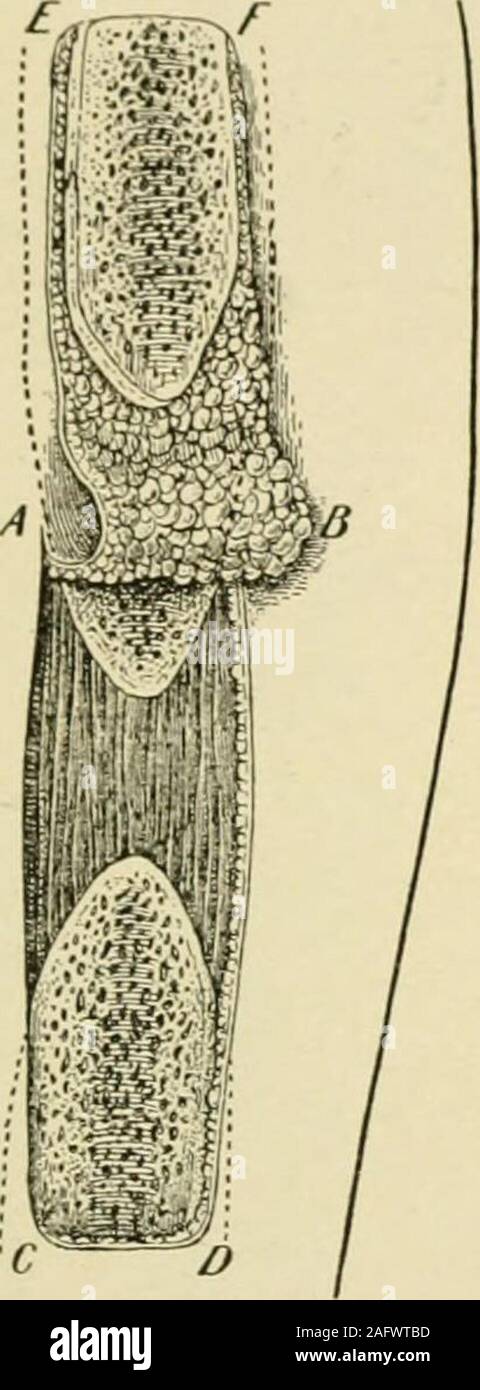 Manual Of Operative Surgery Make The U Shaped Incision A B C D Fig 10 The Points A Andb Being An Inch Or More Above The End Of The Upper Fragments And